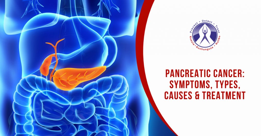 Pancreatic Cancer Symptoms Types Causes And Treatment