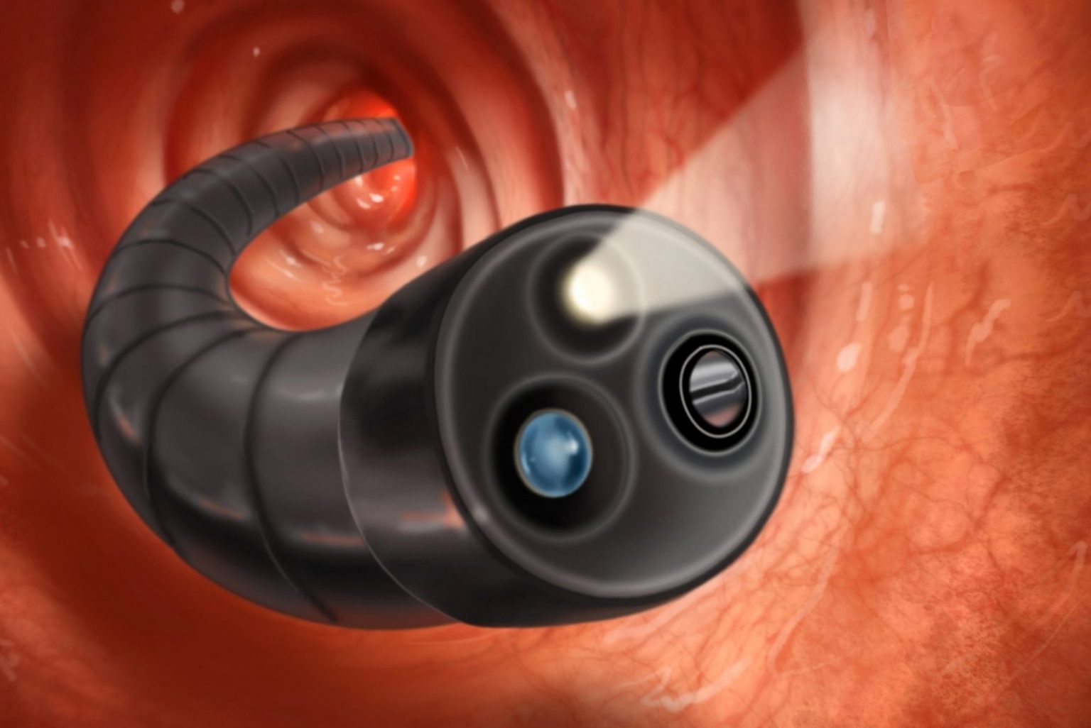 Understanding Oesophago Gastro Duodenoscopy (OGD) And Colonoscopy