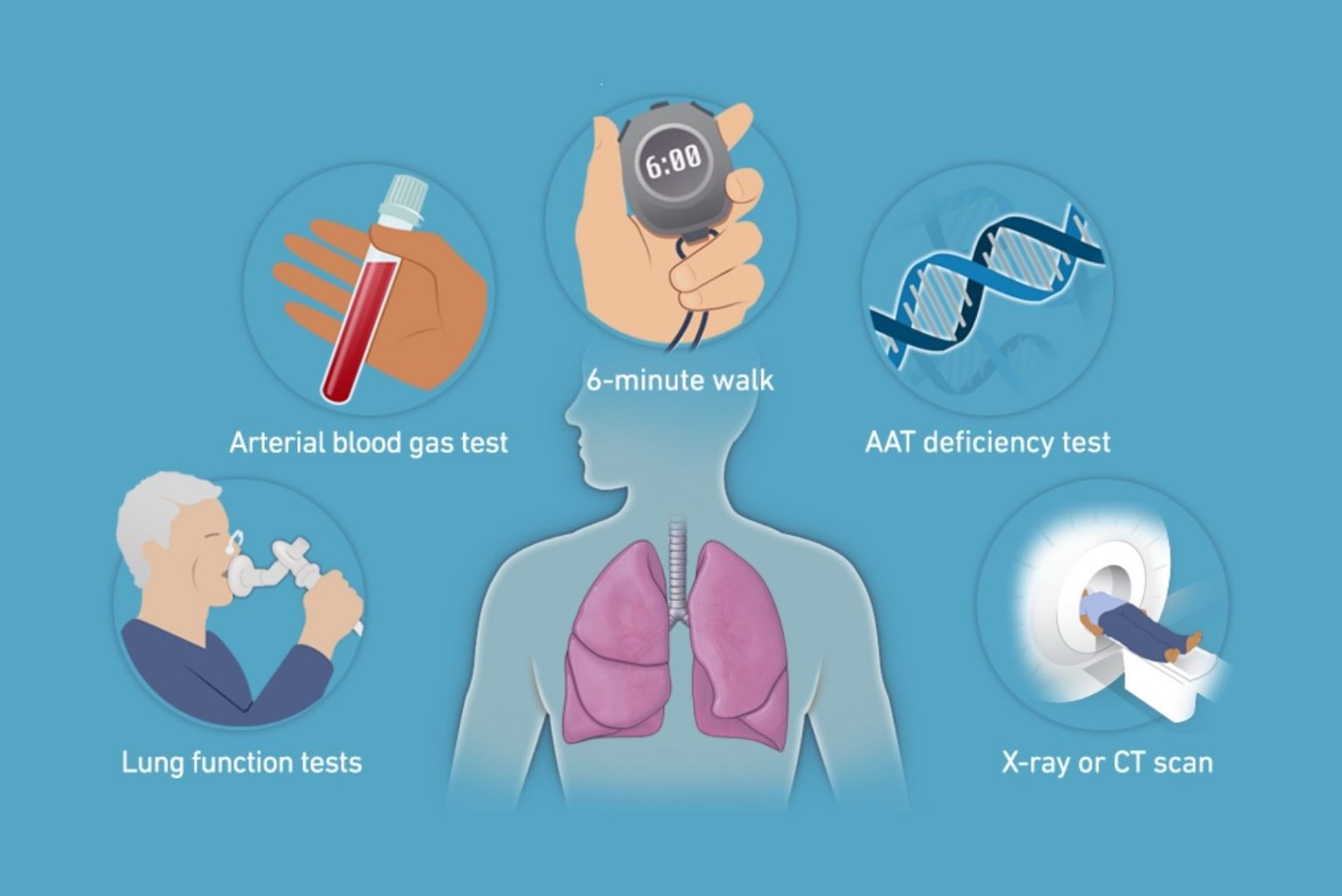 Asthma in Children: Symptoms, Diagnosis, and Treatment - Regency ...