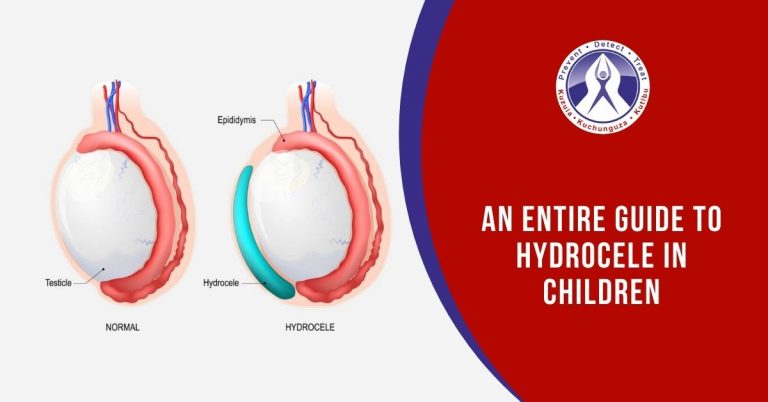 AN ENTIRE GUIDE TO HYDROCELE IN CHILDREN!