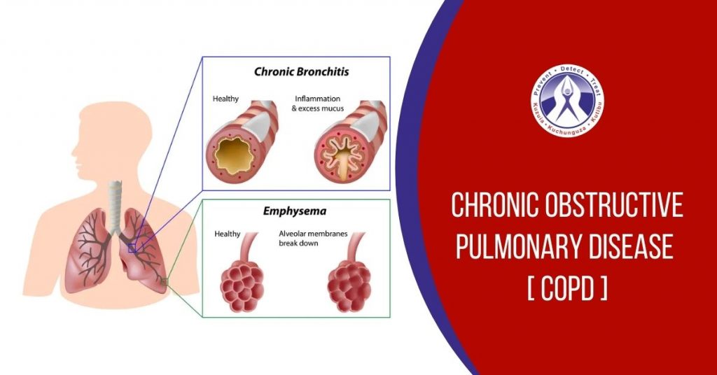 clinical-brief-chronic-obstructive-pulmonary-disease