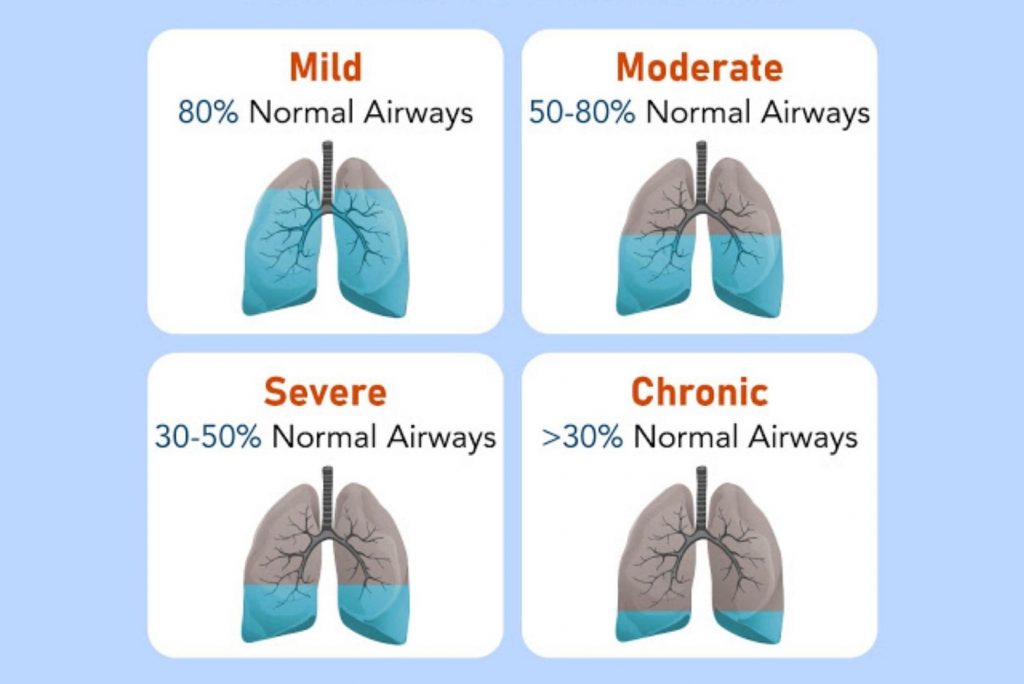 AN INFORMATION GUIDE TO CHRONIC OBSTRUCTIVE PULMONARY DISEASE 