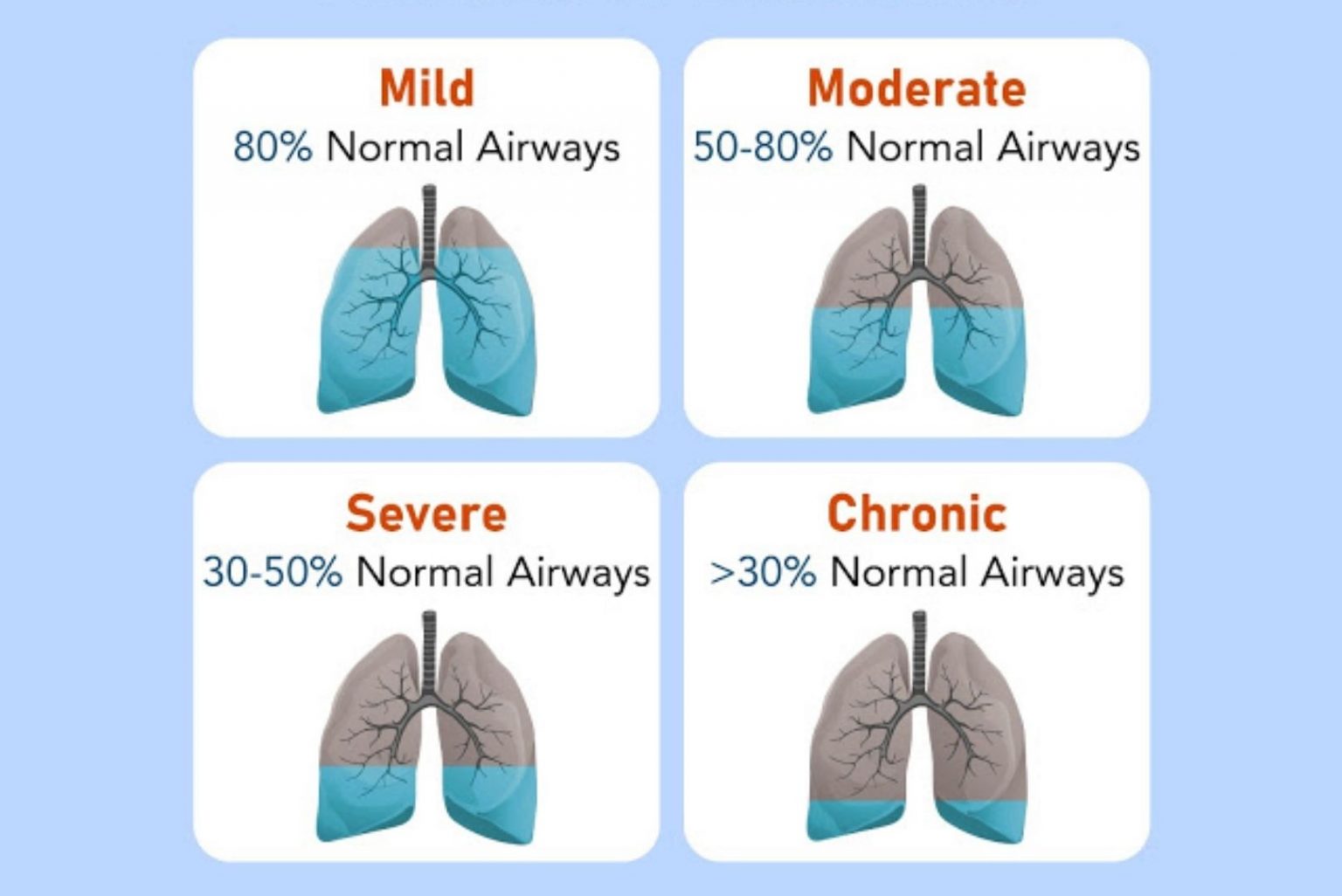 Copd Stages 1536x1026 