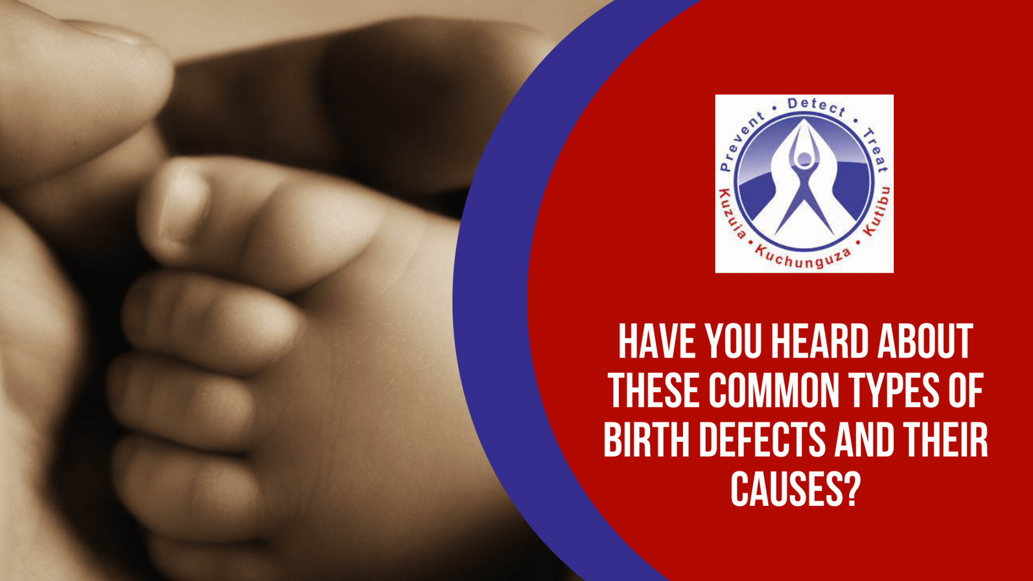 common-types-of-birth-defects-and-their-causes-rmc-tanzania